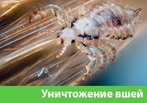 Уничтожение вшей в городе Саратов